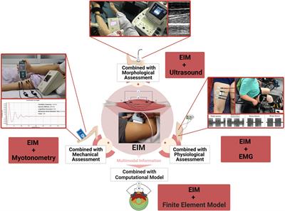 Electrical impedance myography combined with quantitative assessment techniques in paretic muscle of stroke survivors: Insights and challenges